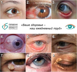 НАШИМ ПАЦИЕНТАМ: Наши офтальмологи исцеляют в режиме «одного дня»