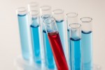 ИЗМЕНИЛАСЬ СХЕМА ПОДТВЕРЖДЕНИЯ РЕЗУЛЬТАТОВ ИССЛЕДОВАНИЙ НА КОРОНАВИРУС
