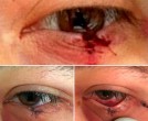 #БудниГКБ15. СИЗ, УВЕЛИЧИТЕЛЬНЫЕ ОЧКИ И БЕСЦЕННЫЙ ОПЫТ