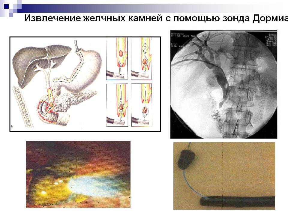 Желчный пузырь