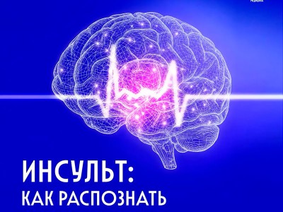 Тест «УДАР»
